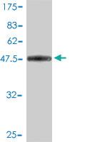 Anti-MREG Mouse Monoclonal Antibody [clone: 8F9-1B2]