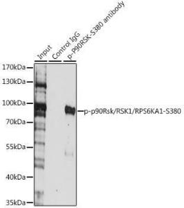 Antibody anti-P90RSK phospho S380 100 µl