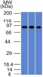 Western blot analysis of A549, HepG2, and HCT116 cell lysates using Anti-Villin Antibody [VIL1/1325]