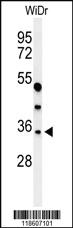 Anti-MAFA Rabbit Polyclonal Antibody