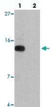 Anti-DDA1 Rabbit Polyclonal Antibody