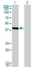 Anti-SMS Mouse Monoclonal Antibody [clone: 1G6]