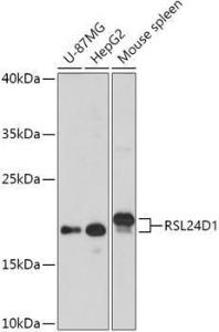 Western blot analysis of extracts of various cell lines, using Anti-RSL24D1 Antibody (A308676) at 1:1000 dilution