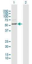 Anti-TBL1X Rabbit Polyclonal Antibody