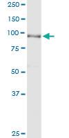 Anti-ACO1 Polyclonal Antibody Pair