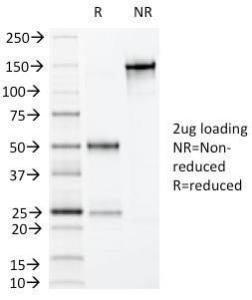 SDS-PAGE analysis of Anti-Villin Antibody [VIL1/1325] under non-reduced and reduced conditions; showing intact IgG and intact heavy and light chains, respectively SDS-PAGE analysis confirms the integrity and purity of the antibody