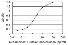 Anti-SMS Mouse Monoclonal Antibody [clone: 1G6]