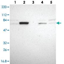 Anti-GRHL1 Rabbit Polyclonal Antibody