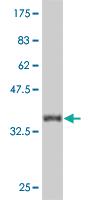 Anti-CAMK2D Mouse Monoclonal Antibody [clone: 1B11]