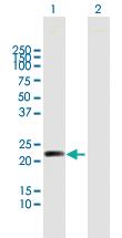 Anti-MYL5 Mouse Polyclonal Antibody