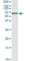 Anti-TBL1X Rabbit Polyclonal Antibody