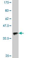 Anti-GSTO1 Mouse Monoclonal Antibody [clone: 1B6]