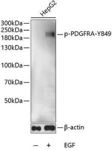 Western blot analysis of extracts of HepG2 cells, using Anti-PDGFR alpha (phospho Tyr849) Antibody (A11047) at 1:1,000 dilution. HepG2 cells were treated by EGF (100ng/ml) for 30 minutes after serum-starvation overnight.