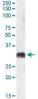 Anti-SRD5A2 Goat Polyclonal Antibody