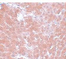 Anti-TMEM70 Rabbit Polyclonal Antibody