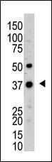 Anti-UCHL5 Rabbit Polyclonal Antibody (FITC (Fluorescein))