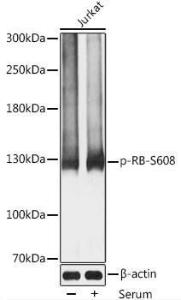 Anti-Rb (phospho Ser608) Antibody (A11048)