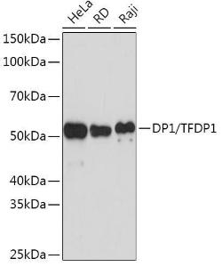 Western blot analysis of extracts of various cell lines, using Anti-DP1 Antibody [ARC1202] (A308679) at 1:1,000 dilution