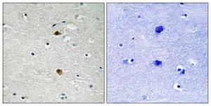 Immunohistochemical analysis of paraffin-embedded human brain tissue using Anti-NF-kappaB p65 Antibody. The right hand panel represents a negative control, where the antibody was pre-incubated with the immunising peptide