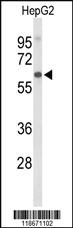 Anti-AFM Rabbit Polyclonal Antibody [clone: 449CT13.4.2]