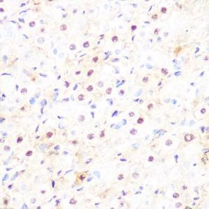 Immunohistochemistry analysis of paraffin-embedded rat ovary using Anti-DP1 Antibody [ARC1202] (A308679) at a dilution of 1:100 (40X lens). Perform microwave antigen retrieval with 10 mM Tris/EDTA buffer pH 9.0 before commencing with IHC staining protocol