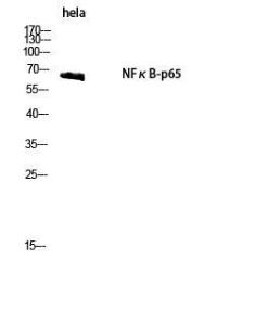 Western blot analysis of hela cells using Anti-NF-kappaB p65 Antibody