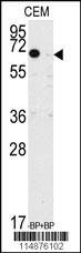 Anti-PRKD3 Rabbit Polyclonal Antibody