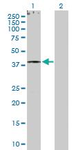 Anti-RXRG Rabbit Polyclonal Antibody