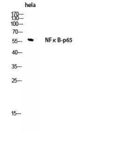 Western blot analysis of hela using Anti-NF-kappaB p65 Antibody