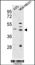 Anti-CTSD Rabbit Polyclonal Antibody