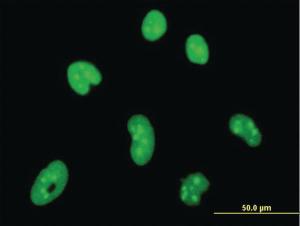 Anti-HMGB1 Mouse Monoclonal Antibody [clone: 1D9]