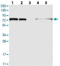 Anti-TBC1D15 Rabbit Polyclonal Antibody