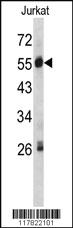 Anti-SERPING1 Rabbit Polyclonal Antibody