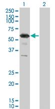 Anti-RXRG Mouse Monoclonal Antibody [clone: 6H1]