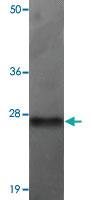 Anti-TMEM70 Rabbit Polyclonal Antibody