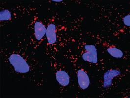 Anti-NEFL + APP Antibody Pair