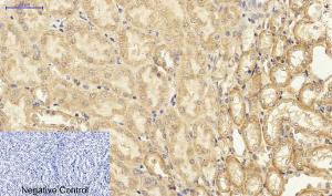 Immunohistochemical analysis of paraffin-embedded mouse kidney tissue using Anti-NF-kappaB p65 Antibody at 1:200 (4 °C overnight). Negative control was secondary antibody only