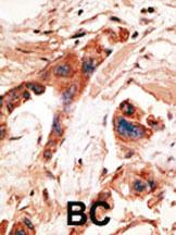 Anti-BMP2K Rabbit Polyclonal Antibody