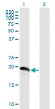 Anti-SUMO3 Mouse Polyclonal Antibody