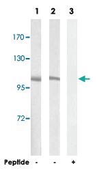 Anti-CNGB1 Rabbit Polyclonal Antibody