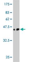 Anti-CAMK2D Mouse Monoclonal Antibody [clone: 4F9]