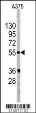 Anti-GOPC Rabbit Polyclonal Antibody (APC (Allophycocyanin))