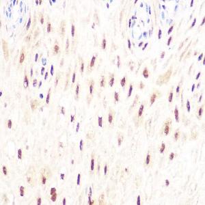 Immunohistochemistry analysis of paraffin-embedded human esophageal using Anti-DP1 Antibody [ARC1202] (A308679) at a dilution of 1:100 (40X lens). Perform microwave antigen retrieval with 10 mM Tris/EDTA buffer pH 9.0 before commencing with IHC staining protocol