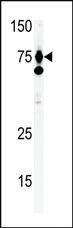 Anti-PTPN20A Rabbit Polyclonal Antibody