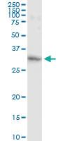 Anti-GSTO1 Antibody Pair