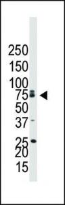 Anti-BMPR1B Rabbit Polyclonal Antibody (APC (Allophycocyanin))