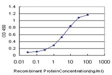 Anti-NKX2-5 Mouse Monoclonal Antibody [clone: S1]