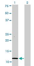 Anti-S100 A1 Mouse Monoclonal Antibody [clone: 1D5]