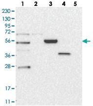 Anti-ZDHHC9 Rabbit Polyclonal Antibody