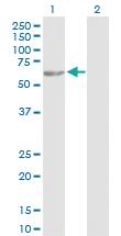 Anti-TBL1X Rabbit Polyclonal Antibody